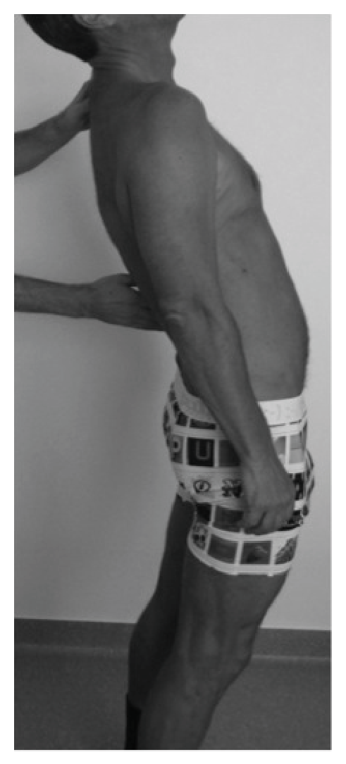 Illustration du questionnaire DLF : En hyperextension