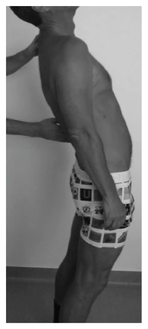 Illustration du questionnaire DLF : En hyperextension