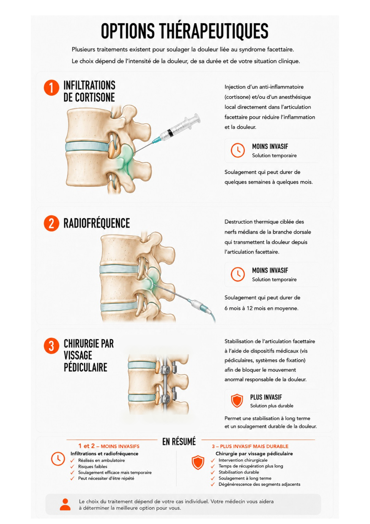 Options thérapeutiques du syndrome facettaire : infiltrations de cortisone, radiofréquence et chirurgie par vissage pédiculaire